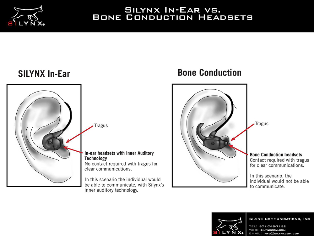 Silynx In-Ear Technology vs Bone Conduction